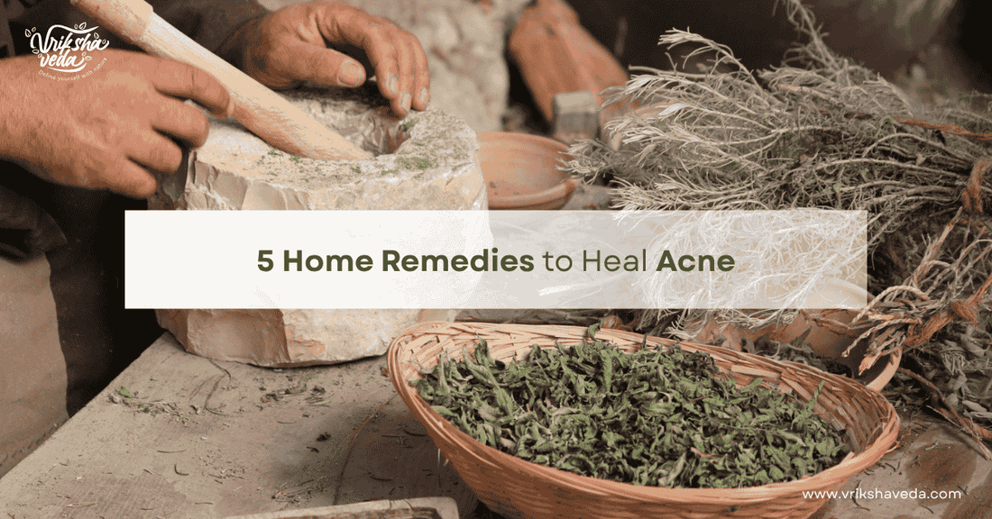 5 Home Remedies to Heal Acne by Vriksha Veda