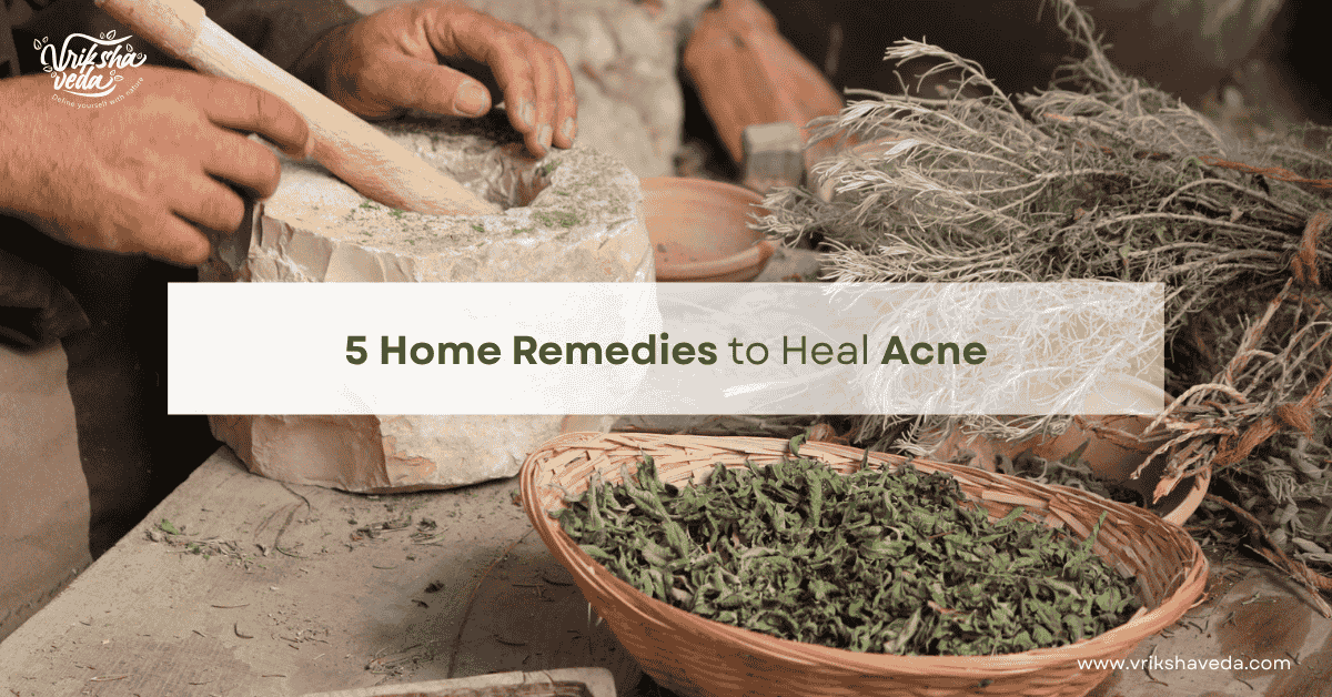 5 Home Remedies to Heal Acne by Vriksha Veda