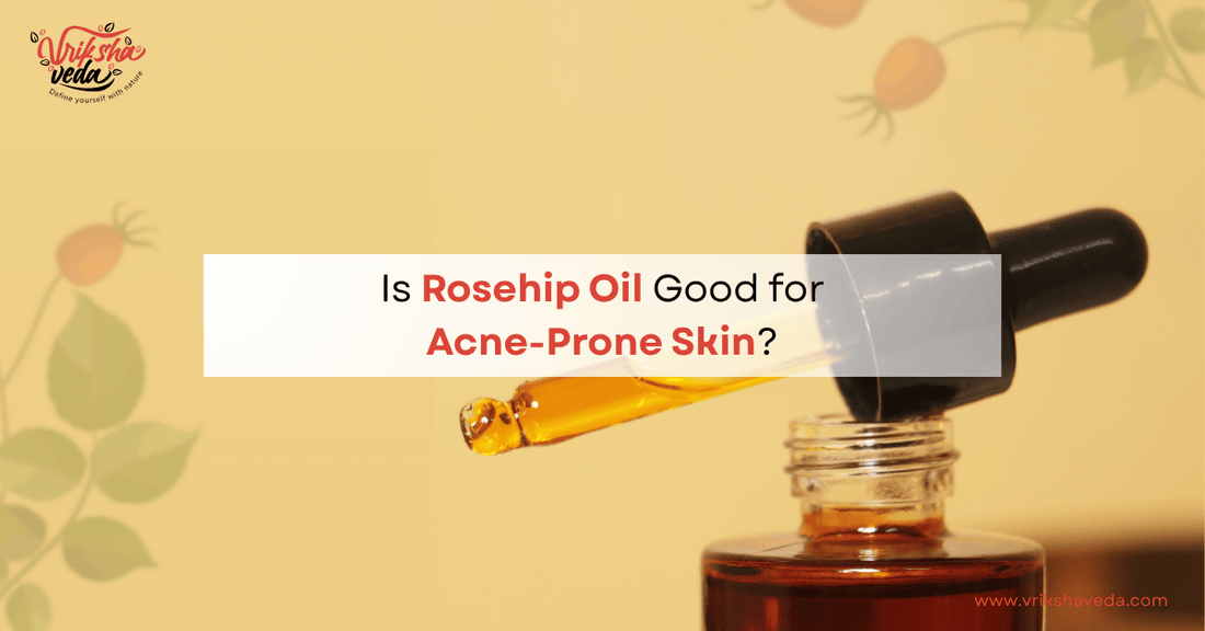 Is Rosehip Oil Good for Acne-Prone Skin?