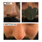 Deep Detox Blackheads Removal Mask | 50 g